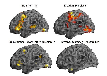 Gehirn.jpg