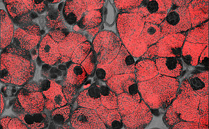 Pancreas_acinar_cells_613_379.jpg  